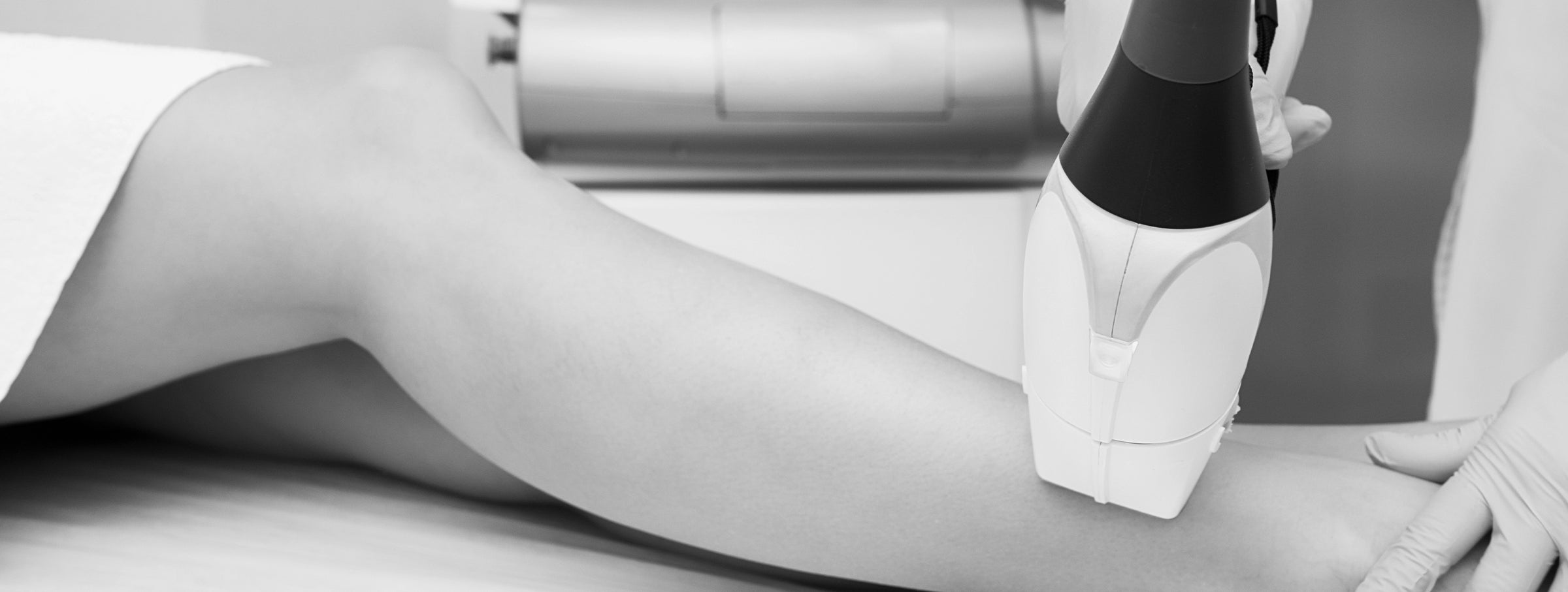 Laser hair removal